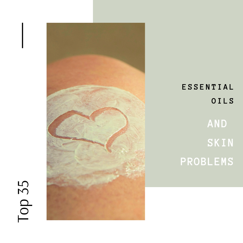 essential oil and skin problem